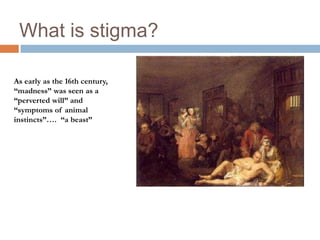 What is stigma?

As early as the 16th century,
“madness” was seen as a
“perverted will” and
“symptoms of animal
instincts”…. “a beast”
 