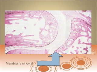 Membrana sinovial
 