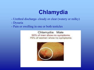 Chlamydia In Men N544- Physical Assessment of the Male GU System, Anus, Rectum and ...