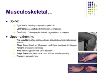 Musculoskeletal…
 Spine:
 Kyphosis: Leading to a posterior pelvic tilt
 Lordosis: Associated with hip flexion contractures
 Scoliosis: Curves greater than 40 degrees tend to progress
 Upper extremity:
 The shoulder is often positioned in an adducted and internally rotated
position
 Elbow flexion: less than 30 degrees rarely have functional significance
 Forearm pronation deformities
 Wrist flexion, typically with ulnar deviation
 Finger flexion and swan neck: hand intrinsic muscle spasticity
 Thumb in palm deformity
 