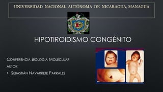 HIPOTIROIDISMO CONGÉNITO
CONFERENCIA BIOLOGÍA MOLECULAR
AUTOR:
• SEBASTIÁN NAVARRETE PARRALES
UNIVERSIDAD NACIONAL AUTÓNOMA DE NICARAGUA, MANAGUA
 