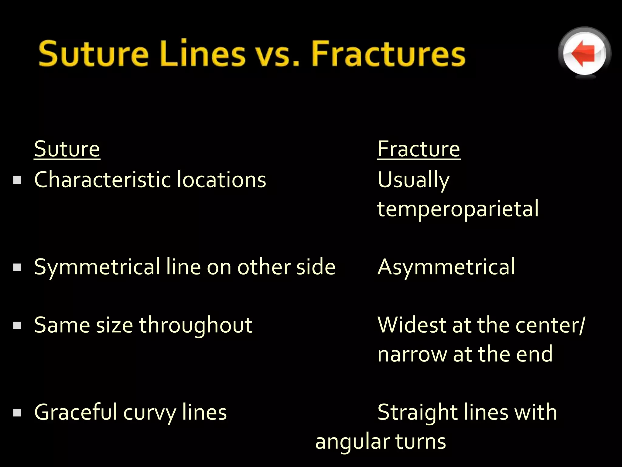 Suture                             Fracture
 Characteristic locations           Usually
                                     temperoparietal

   Symmetrical line on other side   Asymmetrical

   Same size throughout             Widest at the center/
                                     narrow at the end

   Graceful curvy lines             Straight lines with
                               angular turns
 