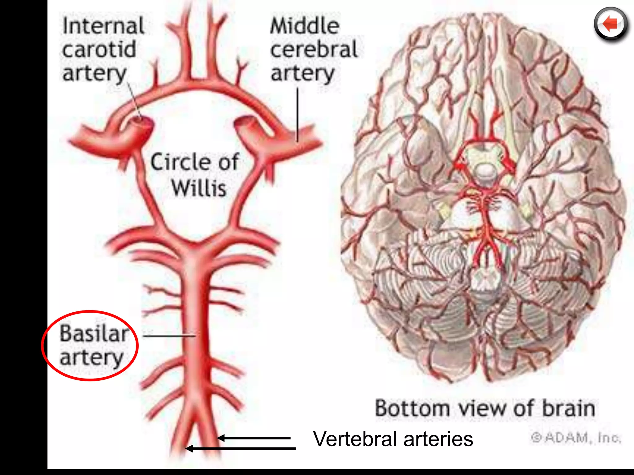 Vertebral arteries
 