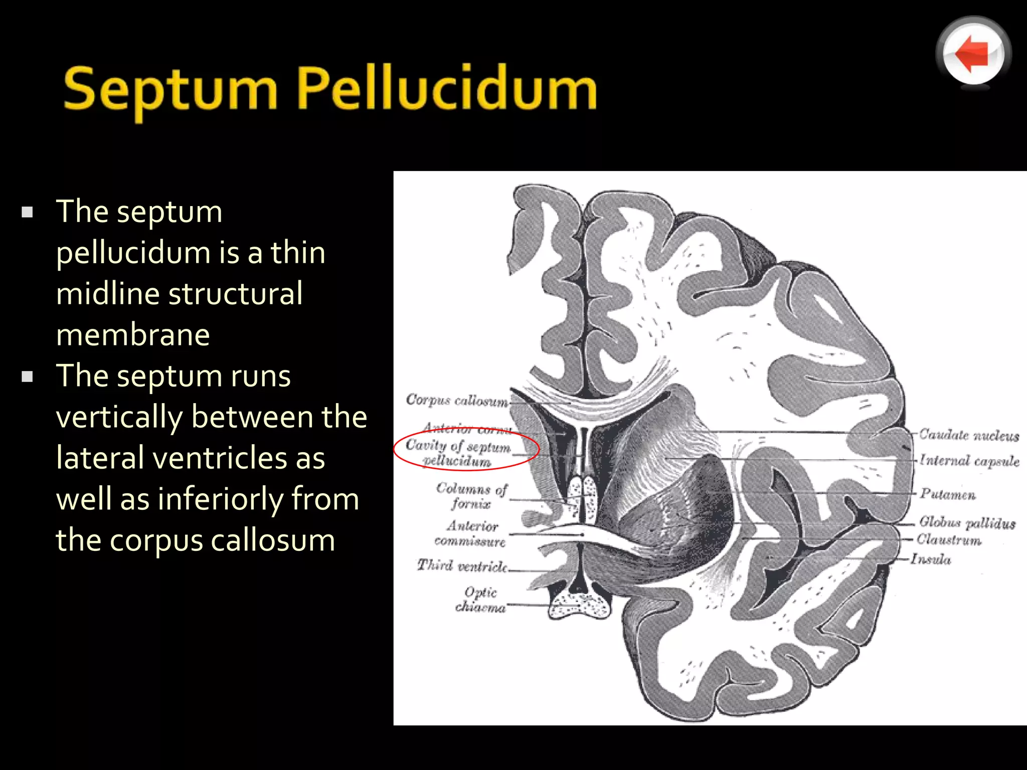    The septum
    pellucidum is a thin
    midline structural
    membrane
   The septum runs
    vertically between the
    lateral ventricles as
    well as inferiorly from
    the corpus callosum
 