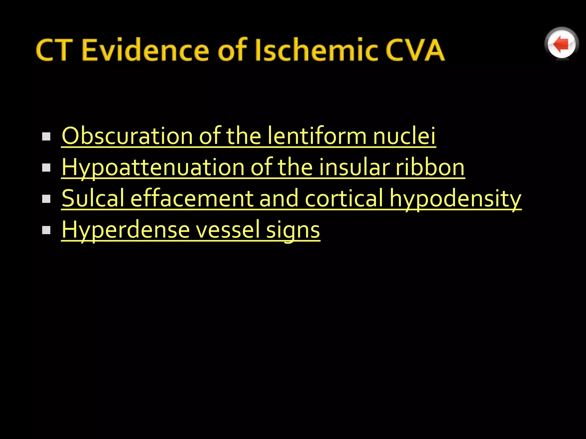    Obscuration of the lentiform nuclei
   Hypoattenuation of the insular ribbon
   Sulcal effacement and cortical hypodensity
   Hyperdense vessel signs
 