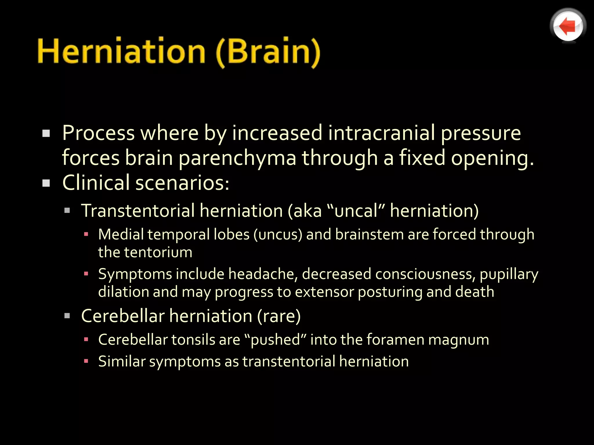  Process where by increased intracranial pressure
  forces brain parenchyma through a fixed opening.
 Clinical scenarios:
     Transtentorial herniation (aka “uncal” herniation)
      ▪ Medial temporal lobes (uncus) and brainstem are forced through
        the tentorium
      ▪ Symptoms include headache, decreased consciousness, pupillary
        dilation and may progress to extensor posturing and death
     Cerebellar herniation (rare)
      ▪ Cerebellar tonsils are “pushed” into the foramen magnum
      ▪ Similar symptoms as transtentorial herniation
 