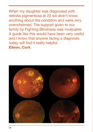 When my daughter was diagnosed with 
retinitis pigmentosa at 23 we didn’t know 
anything about the condition and were very 
overwhelmed. The support given to our 
family by Fighting Blindness was invaluable. 
A guide like this would have been very useful 
and I know that anyone facing a diagnosis 
today will find it really helpful. 
Eileen, Cork 
78 
 