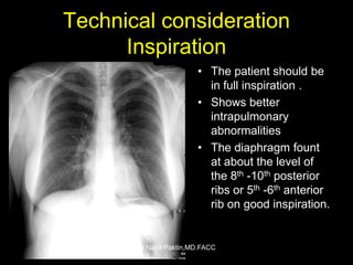 Inspiration Normal Ribs Chest-X ray , How to read a CXR | PPSX