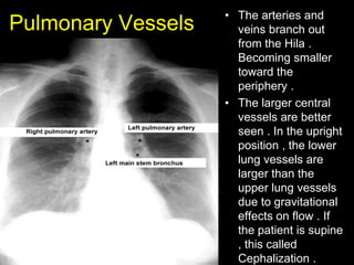 Chest-X ray , How to read a CXR | PPSX