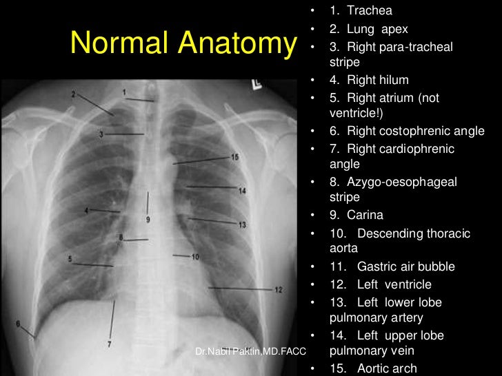ChestX ray , How to read a CXR