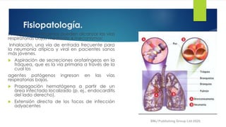 Fisiopatología.
Los agentes patógenos pueden alcanzar las vías
respiratorias bajas mediante 4 mecanismos:
Inhalación, una vía de entrada frecuente para
la neumonía atípica y viral en pacientes sanos
más jóvenes.
 Aspiración de secreciones orofaríngeas en la
tráquea, que es la vía primaria a través de la
cual los
agentes patógenos ingresan en las vías
respiratorias bajas.
 Propagación hematógena a partir de un
àrea infectado localizado (p. ej., endocarditis
del lado derecho).
 Extensión directa de los focos de infección
adyacentes
BMJ Publishing Group Ltd 2020.
 