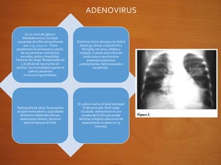 ADENOVIRUS
Es un virus del género
Mastadenovirus, los tipos
causantes de infección pulmonar
son: 1-5, 7,14 y 21 . Tiene
predominioen primaveray otoño.
Se encuentraen reclusorios,
escuelas, asilos y hospitales.
Factores de riesgo: Responsable de
1 al 3% de las neumonías en
adultos, con mortalidad superior al
50% en pacientes
inmunocomprometidos.
Síntomas: Inicio abrupto con fiebre
hasta 39, coriza, conjuntivitis y
faringitis, tos seca, cefalea y
mialgias. Cuando esta infección
evoluciona a neumonía se
presentan estertores
subcrepitantes,fiebre elevada y
escalofríos .
Radiografia de tórax: Se presenta
atrapamientoaéreo y opacidades
alveolares bilaterales difusas,
atelectasias lobares, derrame
pleural hasta en el 62%.
El cultivo viral es el Gold standard
El denominado Shell viales
incubado.Adenoclone es una
prueba de ELISA que puede
detectar antígeno adenoviral de
especímenes oculares en 75
minutos,
 