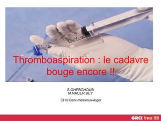Thromboaspiration : le cadavre
bouge encore !!
S.GHEBGHOUB
M.NACER BEY
CHU Beni messous-Alger
 