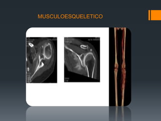 MUSCULOESQUELETICO
 
