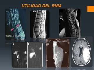 UTILIDAD DEL RNM
 