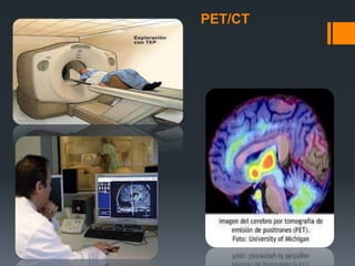 PET/CT
 