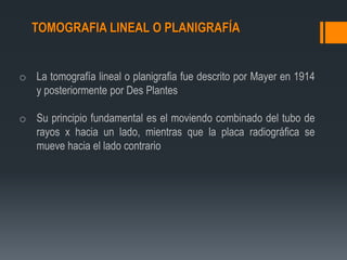 TOMOGRAFIA LINEAL O PLANIGRAFÍA
o La tomografía lineal o planigrafia fue descrito por Mayer en 1914
y posteriormente por Des Plantes
o Su principio fundamental es el moviendo combinado del tubo de
rayos x hacia un lado, mientras que la placa radiográfica se
mueve hacia el lado contrario
 