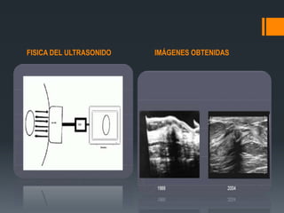 FISICA DEL ULTRASONIDO IMÁGENES OBTENIDAS
 
