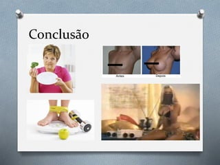 Conclusão
 