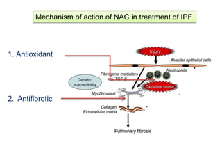 Mechanism of action of NAC in treatment of IPF
1. Antioxidant
2. Antifibrotic
 