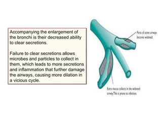 Accompanying the enlargement of
the bronchi is their decreased ability
to clear secretions.
Failure to clear secretions allows
microbes and particles to collect in
them, which leads to more secretions
and inflammation that further damage
the airways, causing more dilation in
a vicious cycle.
 