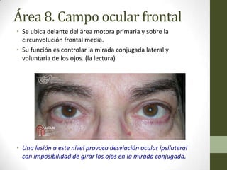 Área 8. Campo ocular frontal
• Se ubica delante del área motora primaria y sobre la
  circunvolución frontal media.
• Su función es controlar la mirada conjugada lateral y
  voluntaria de los ojos. (la lectura)




• Una lesión a este nivel provoca desviación ocular ipsilateral
  con imposibilidad de girar los ojos en la mirada conjugada.
 