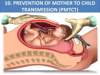 10. PREVENTION OF MOTHER TO CHILD
TRANSMISSION (PMTCT)
 