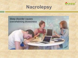 Nacrolepsy
 