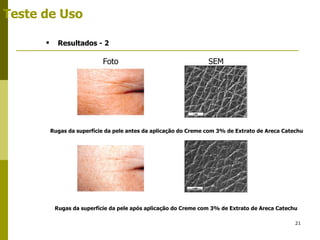 Rugas da superfície da pele antes da aplicação do Creme com 3% de Extrato de Areca Catechu Resultados - 2 Teste de Uso Rugas da superfície da pele após aplicação do Creme com 3% de Extrato de Areca Catechu Foto SEM 