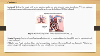 Figure: Automatic implantable cardioverter-defibrillator (AICD)
Continued…
Implanted devices: In people with severe cardiomyopathy, or with recurrent venous thrombosis (VT), or malignant
arrhythmias, treatment with an automatic implantable cardioverter-defibrillator (AICD) is indicated.
Surgical therapies: In selected cases, heart transplantation may be considered (scarcity of available heart for transplantation is
a major challenge).
Palliative care: People with heart failure often have significant symptoms (shortness of breath and chest pain). Palliative care
can not only provide symptom management, also assist with advanced care planning.
 
