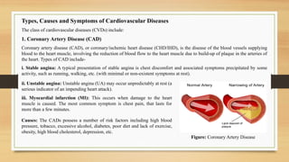 Types, Causes and Symptoms of Cardiovascular Diseases
The class of cardiovascular diseases (CVDs) include:
1. Coronary Artery Disease (CAD)
Coronary artery disease (CAD), or coronary/ischemic heart disease (CHD/IHD), is the disease of the blood vessels supplying
blood to the heart muscle, involving the reduction of blood flow to the heart muscle due to build-up of plaque in the arteries of
the heart. Types of CAD include-
i. Stable angina: A typical presentation of stable angina is chest discomfort and associated symptoms precipitated by some
activity, such as running, walking, etc. (with minimal or non-existent symptoms at rest).
Figure: Coronary Artery Disease
ii. Unstable angina: Unstable angina (UA) may occur unpredictably at rest (a
serious indicator of an impending heart attack).
iii. Myocardial infarction (MI): This occurs when damage to the heart
muscle is caused. The most common symptom is chest pain, that lasts for
more than a few minutes.
Causes: The CADs possess a number of risk factors including high blood
pressure, tobacco, excessive alcohol, diabetes, poor diet and lack of exercise,
obesity, high blood cholesterol, depression, etc.
 