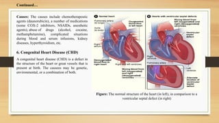 Causes: The causes include chemotherapeutic
agents (daunorubicin), a number of medications
(some COX-2 inhibitors, NSAIDs, anesthetic
agents), abuse of drugs (alcohol, cocaine,
methamphetamine), complicated situations
during blood and serum infusions, kidney
diseases, hyperthyroidism, etc.
6. Congenital Heart Disease (CHD)
A congenital heart disease (CHD) is a defect in
the structure of the heart or great vessels that is
present at birth. The causees may be genetic,
environmental, or a combination of both.
Figure: The normal structure of the heart (in left), in comparison to a
ventricular septal defect (in right)
Continued…
 