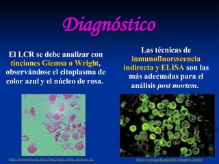 Diagnóstico El LCR se debe analizar con  tinciones Giemsa o Wright , observándose el citoplasma de color azul y el núcleo de rosa.   Las técnicas de  inmunofluorescencia   indirecta y ELISA  son las más adecuadas para el análisis  post mortem .   http// www.smm.org / buzz / blog / brain_eating_amoebas_si ...   http :// en.wikipedia.org / wiki / Naegleria_fowleri 