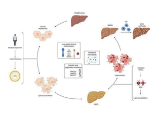 NAFLD non alcoholic fatty liver disease.pptx
