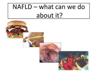 NAFLD – what can we do
about it?
 