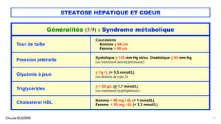 Claude EUGÈNE
STEATOSE HÉPATIQUE ET COEUR
23
Généralités (5/9) : Syndrome métabolique
Tour de taille
Caucasiens
Homme > 94 cm
Femme > 80 cm
Pression artérielle
Systolique > 130 mm Hg et/ou Diastolique > 85 mm Hg
(ou traitement anti-hypertenseur)
Glycémie à jeun
> 1g / L (> 5,5 mmol/L)
(ou diabète de type 2)
Triglycérides
> 1,50 g/L (> 1,7 mmol/L)
(ou traitement hypolipémiant)
Cholestérol HDL
Homme < 40 mg / dL (< 1 mmol/L)
Femme < 50 mg / dL (< 1,3 mmol/L)
 