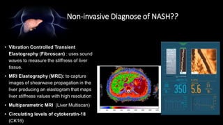 Non-invasive Diagnose of NASH??
• Vibration Controlled Transient
Elastography (Fibroscan) : uses sound
waves to measure the stiffness of liver
tissue.
• MRI Elastography (MRE): to capture
images of shearwave propagation in the
liver producing an elastogram that maps
liver stiffness values with high resolution
• Multiparametric MRI (Liver Multiscan)
• Circulating levels of cytokeratin-18
(CK18)
 