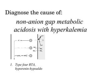 Nagma Algorithm Non-anion gap Metabolic Acidosis (NAGMA) | PPT