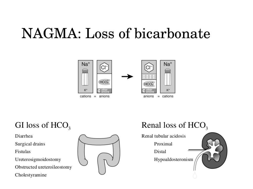 Non anion gap metabolic acidosis nagma 