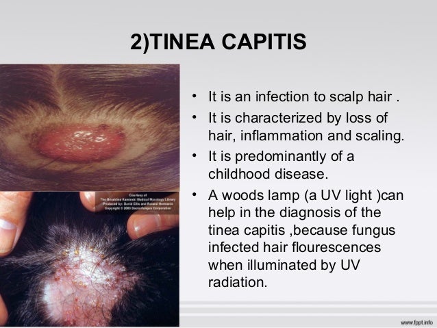 fungal diseases in humans and animals