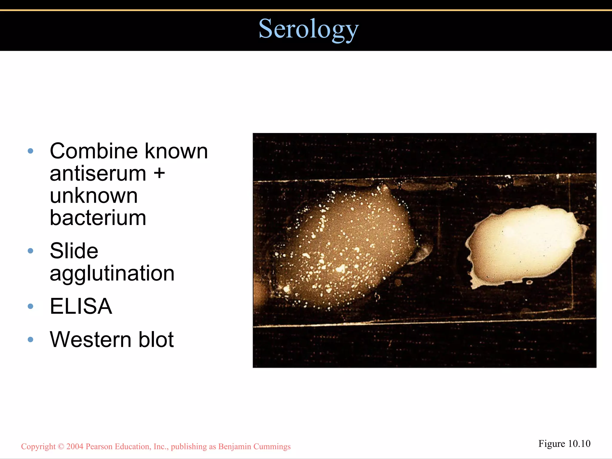 Combine known antiserum + unknown bacterium Slide agglutination ELISA Western blot Serology Figure 10.10 