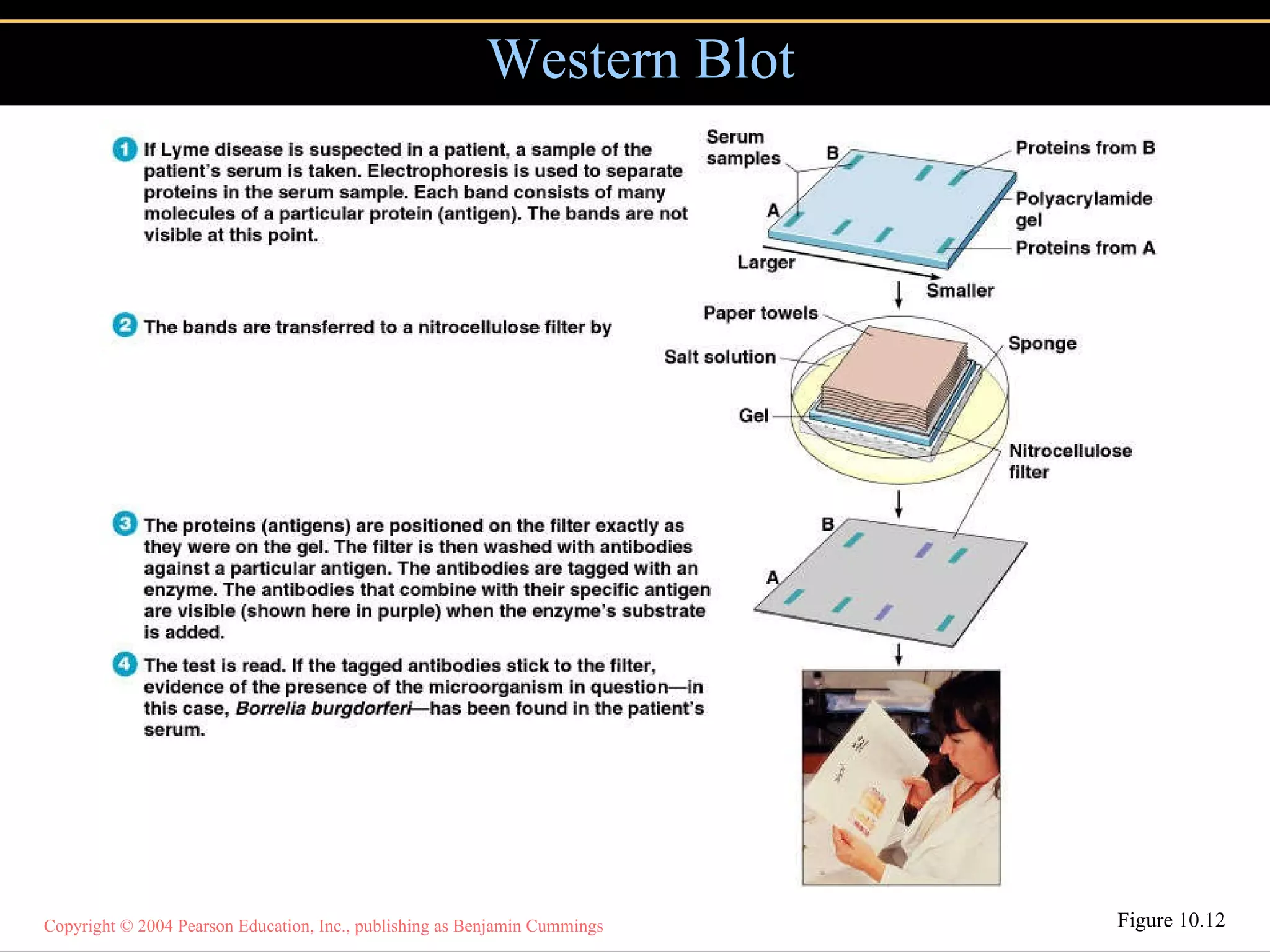 Western Blot Figure 10.12 