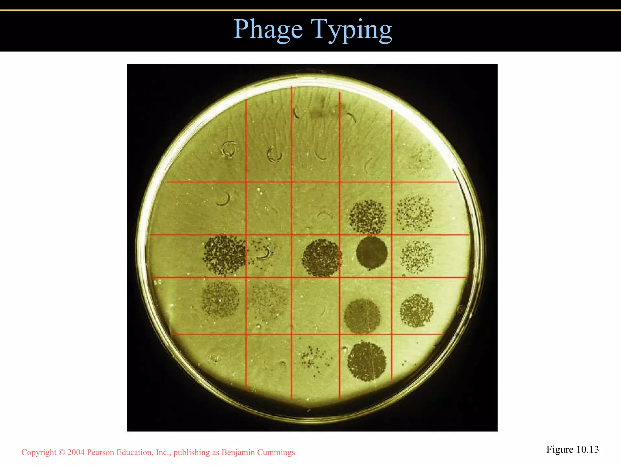 Phage Typing Figure 10.13 