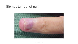Nail DERMATOLOGY REVISION NOTES PPTX nail-dermatology-revision-notes-pptx