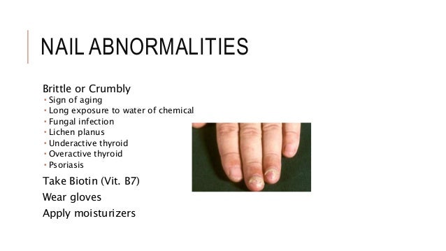 Nail Abnormalities
