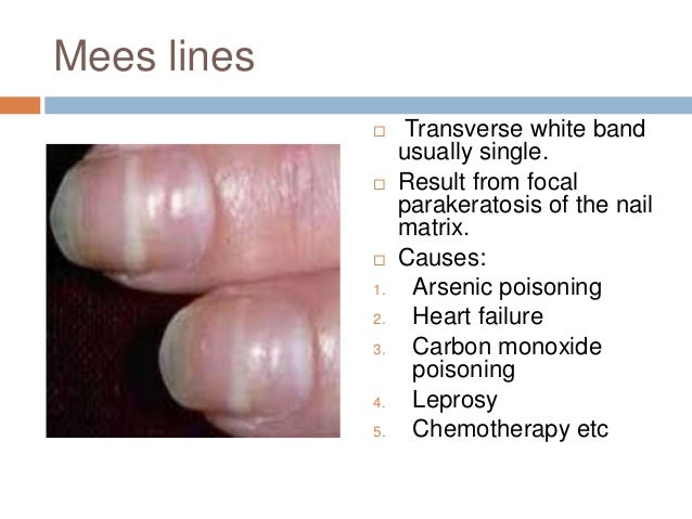 Nail Anatomy And Its Disorders