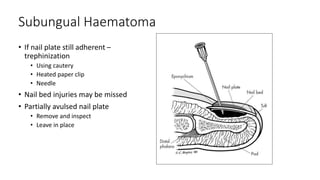 Subungual Haematoma
• If nail plate still adherent –
trephinization
• Using cautery
• Heated paper clip
• Needle
• Nail bed injuries may be missed
• Partially avulsed nail plate
• Remove and inspect
• Leave in place
 