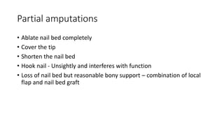 Partial amputations
• Ablate nail bed completely
• Cover the tip
• Shorten the nail bed
• Hook nail - Unsightly and interferes with function
• Loss of nail bed but reasonable bony support – combination of local
flap and nail bed graft
 