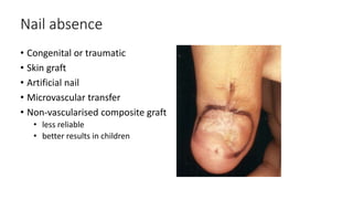 Nail absence
• Congenital or traumatic
• Skin graft
• Artificial nail
• Microvascular transfer
• Non-vascularised composite graft
• less reliable
• better results in children
 