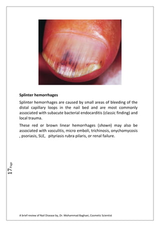 a brief review of nail diseases by, Dr. Mohammad Baghaei | PDF